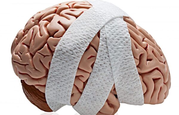 Acquired Brain Injury